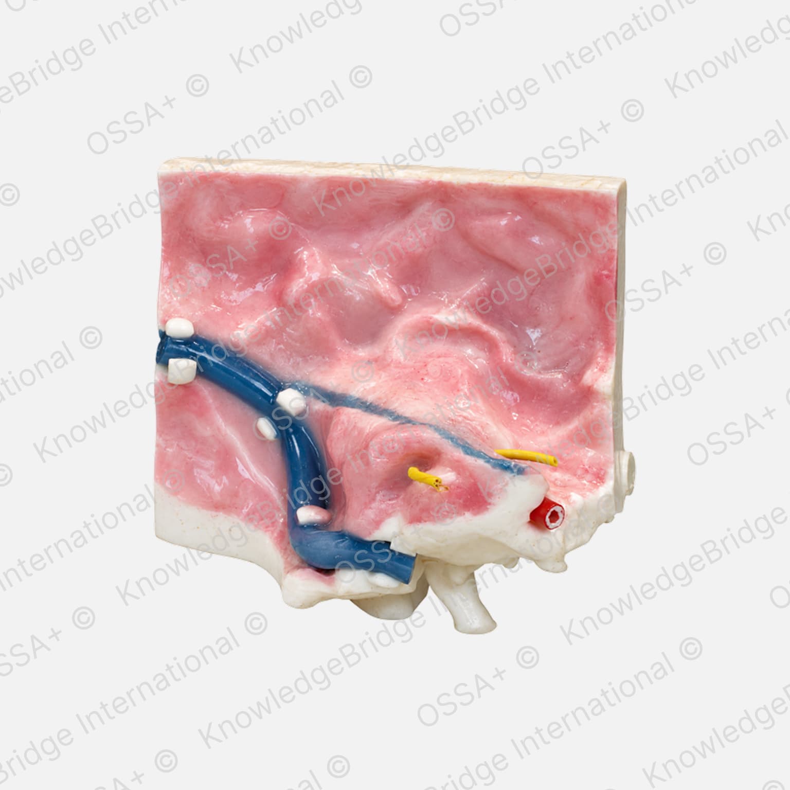 Medical simulation model