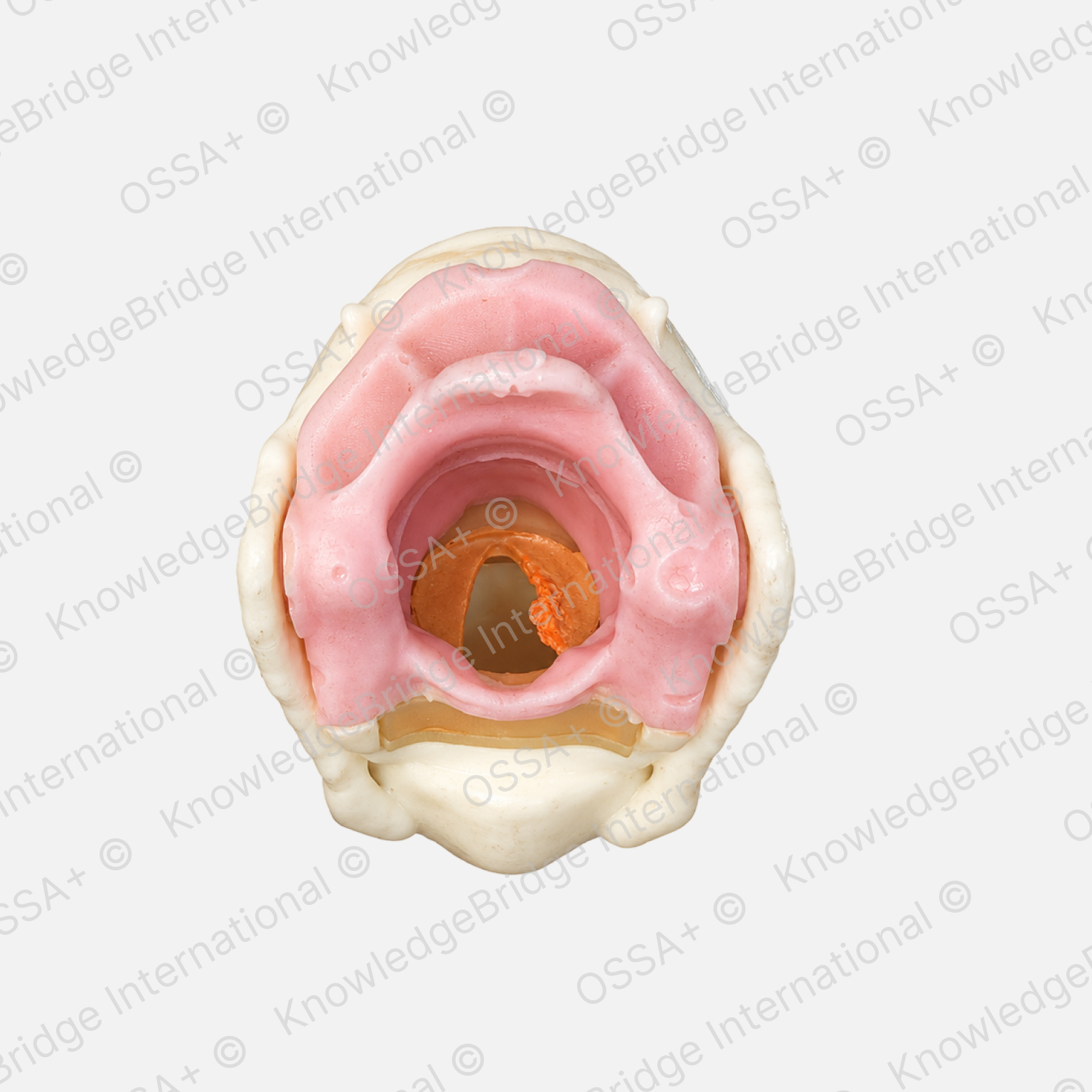 Artificial Larynx Model view 1