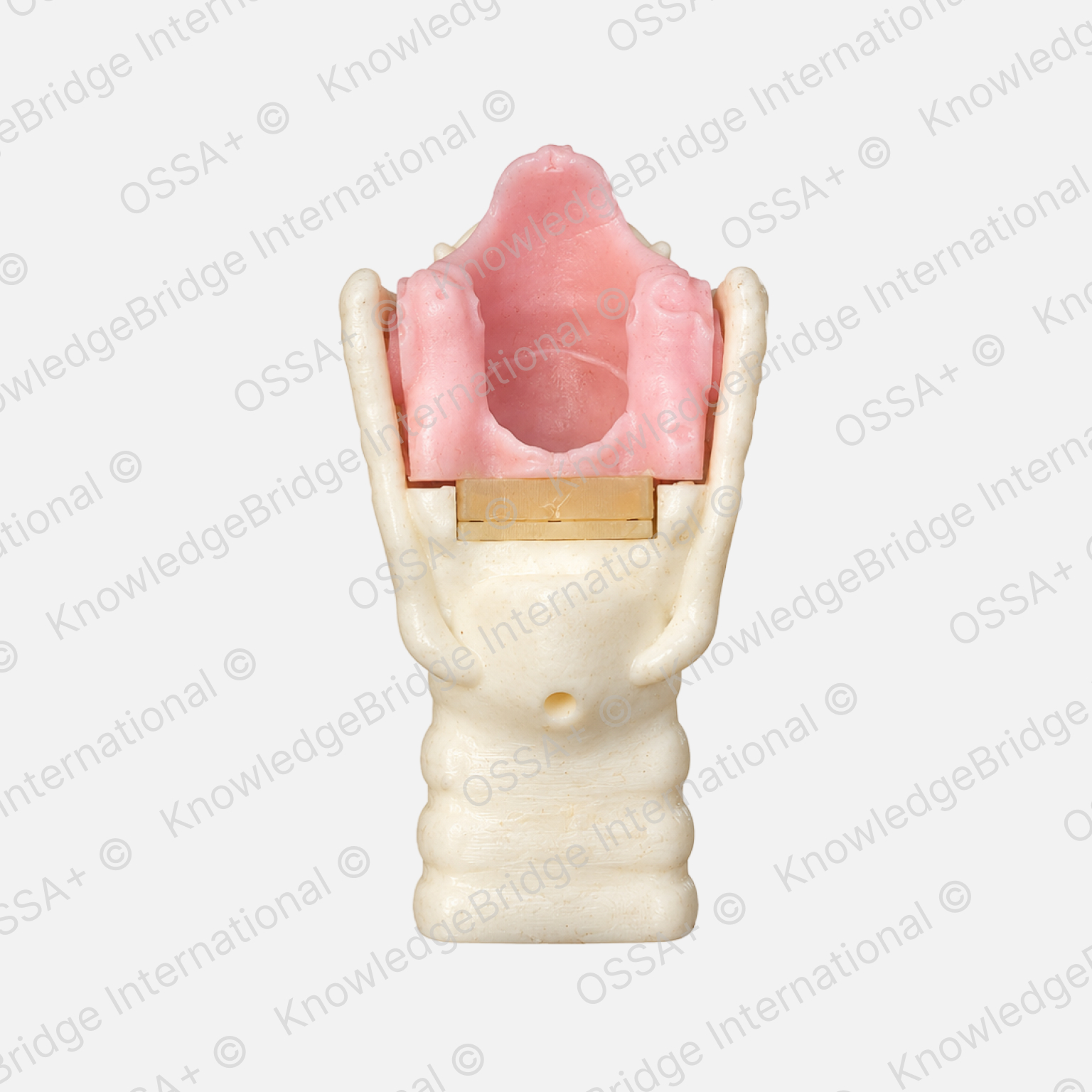 Artificial Larynx Model view 2